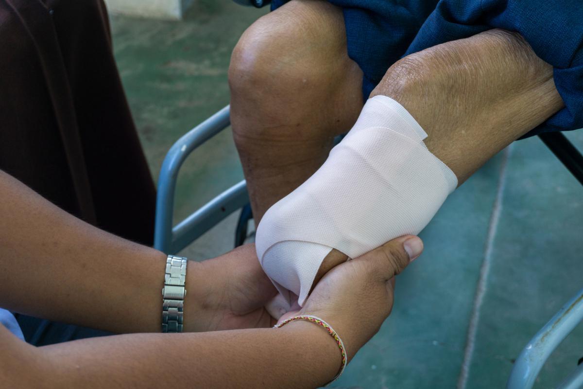 Workers’ Compensation and Workplace Injury-Related Amputations
